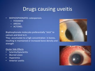 Drugs causing uveitis
• BISPHOSPHONATES: osteoporosis.
– FOSAMAX
– AREDIA
– ACTONEL
Bisphosphonate molecules preferentially "stick" to
calcium and bind to it.
They accumulate to a high concentration in bones,
resulting in maintained or increased bone density and
strength
Ocular Side Effects
• Scleritis/Episcleritis
• Blurred vision
• Hyperemia
• Anterior uveitis
 