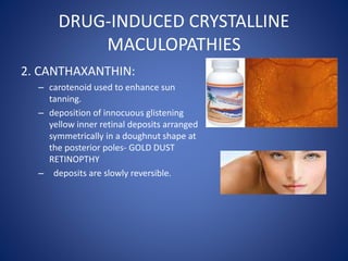 DRUG-INDUCED CRYSTALLINE
MACULOPATHIES
2. CANTHAXANTHIN:
– carotenoid used to enhance sun
tanning.
– deposition of innocuous glistening
yellow inner retinal deposits arranged
symmetrically in a doughnut shape at
the posterior poles- GOLD DUST
RETINOPTHY
– deposits are slowly reversible.
 