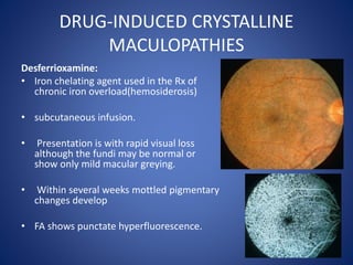 DRUG-INDUCED CRYSTALLINE
MACULOPATHIES
Desferrioxamine:
• Iron chelating agent used in the Rx of
chronic iron overload(hemosiderosis)
• subcutaneous infusion.
• Presentation is with rapid visual loss
although the fundi may be normal or
show only mild macular greying.
• Within several weeks mottled pigmentary
changes develop
• FA shows punctate hyperfluorescence.
 