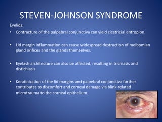 STEVEN-JOHNSON SYNDROME
Eyelids:
• Contracture of the palpebral conjunctiva can yield cicatricial entropion.
• Lid margin inflammation can cause widespread destruction of meibomian
gland orifices and the glands themselves.
• Eyelash architecture can also be affected, resulting in trichiasis and
distichiasis.
• Keratinization of the lid margins and palpebral conjunctiva further
contributes to discomfort and corneal damage via blink-related
microtrauma to the corneal epithelium.
 