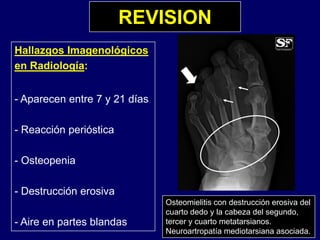 REVISION
Hallazgos Imagenológicos
en Radiología:en Radiología:
- Aparecen entre 7 y 21 díasp y
- Reacción perióstica
- Osteopenia
- Destrucción erosiva
Osteomielitis con destrucción erosiva del
- Aire en partes blandas
cuarto dedo y la cabeza del segundo,
tercer y cuarto metatarsianos.
Neuroartropatía mediotarsiana asociada.
 