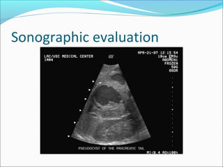 Sonographic evaluation
 