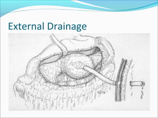 External Drainage
 