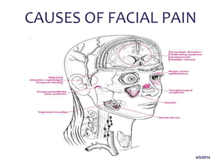 4/5/2014
CAUSES OF FACIAL PAIN
 