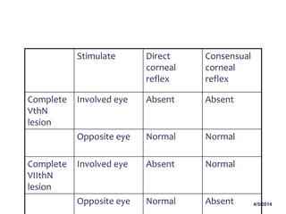 4/5/2014
Stimulate Direct
corneal
reflex
Consensual
corneal
reflex
Complete
VthN
lesion
Involved eye Absent Absent
Opposite eye Normal Normal
Complete
VIIthN
lesion
Involved eye Absent Normal
Opposite eye Normal Absent
 