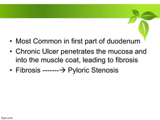 • Most Common in first part of duodenum
• Chronic Ulcer penetrates the mucosa and
into the muscle coat, leading to fibrosis
• Fibrosis ------- Pyloric Stenosis
 