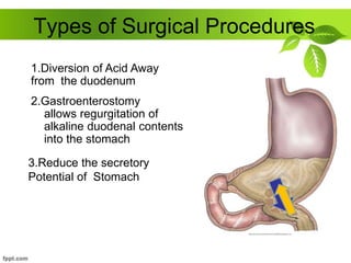 Types of Surgical Procedures
2.Gastroenterostomy
allows regurgitation of
alkaline duodenal contents
into the stomach
1.Diversion of Acid Away
from the duodenum
3.Reduce the secretory
Potential of Stomach
 