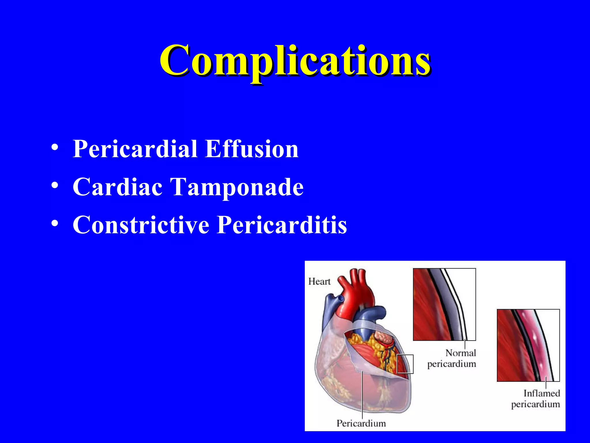 Pericarditis, Pericardial Effusion, & Cardiac Tamponade - BMH/Tele | PPT