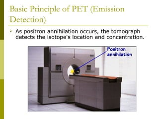 Basic Principle of PET (Emission
Detection)
 As positron annihilation occurs, the tomograph
detects the isotope's location and concentration.
 