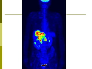 Positron emission tomography