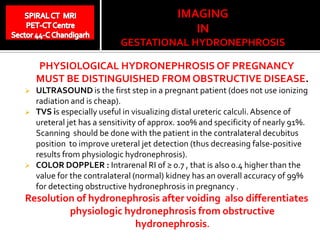 Pregnancy induced dilatation of the urinary system | PPT