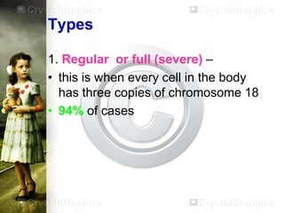 Types
1. Regular or full (severe) –
• this is when every cell in the body
has three copies of chromosome 18
• 94% of cases

 