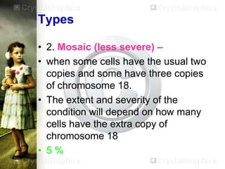 Types
• 2. Mosaic (less severe) –
• when some cells have the usual two
copies and some have three copies
of chromosome 18.
• The extent and severity of the
condition will depend on how many
cells have the extra copy of
chromosome 18
• 5%

 