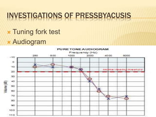 INVESTIGATIONS OF PRESSBYACUSIS
 Tuning fork test
 Audiogram
 