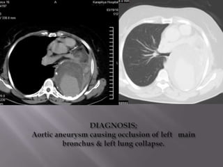 RADIOLOGY PRESENTATION | PPT