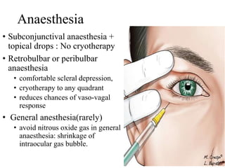 Anaesthesia
• Subconjunctival anaesthesia +
topical drops : No cryotherapy
• Retrobulbar or peribulbar
anaesthesia
• comfortable scleral depression,
• cryotherapy to any quadrant
• reduces chances of vaso-vagal
response
• General anesthesia(rarely)
• avoid nitrous oxide gas in general
anaesthesia: shrinkage of
intraocular gas bubble.
 