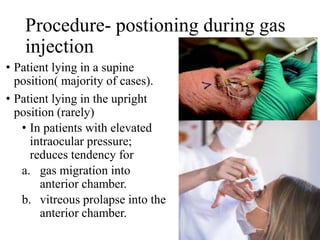 Procedure- postioning during gas
injection
• Patient lying in a supine
position( majority of cases).
• Patient lying in the upright
position (rarely)
• In patients with elevated
intraocular pressure;
reduces tendency for
a. gas migration into
anterior chamber.
b. vitreous prolapse into the
anterior chamber.
 