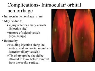 Complications- Intraocular/ orbital
hemorrhage
• Intraocular hemorrhage is rare
• May be due to
injury anterior ciliary vessels
(injection site)
rupture of scleral vessels
(cryotherapy)
• Reduce by
avoiding injection along the
vertical and horizontal meridians
(anterior ciliary vessels).
Tip of cryoprobe should be
allowed to thaw before removal
from the ocular surface.
 