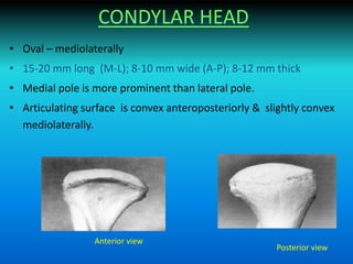 CONDYLAR HEAD
• Oval – mediolaterally
• 15-20 mm long (M-L); 8-10 mm wide (A-P); 8-12 mm thick
• Medial pole is more prominent than lateral pole.
• Articulating surface is convex anteroposteriorly & slightly convex
mediolaterally.
Anterior view
Posterior view
 