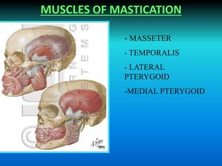 MUSCLES OF MASTICATION
- MASSETER
- TEMPORALIS
- LATERAL
PTERYGOID
-MEDIAL PTERYGOID
 