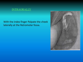 With the index finger Palpate the cheek
laterally at the Retromolar fossa.
INTRAORALLY
 