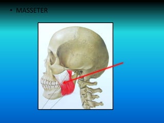 • MASSETER
 