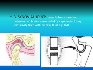 • 3. SYNOVIAL JOINT: permits free movement
between two bones; surrounded by capsule enclosing
joint cavity filled with synovial fluid. Eg: TMJ
 