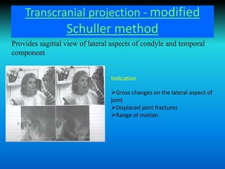 Transcranial projection - modified
Schuller method
Provides sagittal view of lateral aspects of condyle and temporal
component
Indication
Gross changes on the lateral aspect of
joint
Displaced joint fractures
Range of motion
 