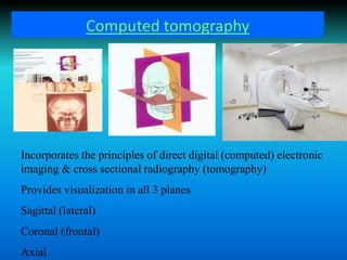 Computed tomography
Incorporates the principles of direct digital (computed) electronic
imaging & cross sectional radiography (tomography)
Provides visualization in all 3 planes
Sagittal (lateral)
Coronal (frontal)
Axial
 