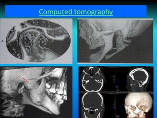 Computed tomography
 