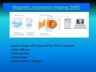 Magnetic resonance imaging (MRI)
Used to image soft tissues of the TMJ to visualize
Joint effusion
Disk position
Disk shape
Inflammatory changes
 