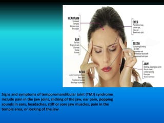 Signs and symptoms of temporomandibular joint (TMJ) syndrome
include pain in the jaw joint, clicking of the jaw, ear pain, popping
sounds in ears, headaches, stiff or sore jaw muscles, pain in the
temple area, or locking of the jaw
 