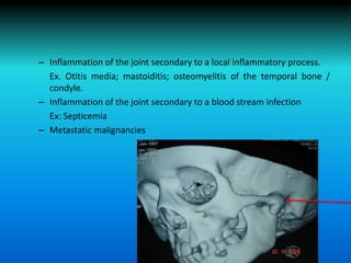 – Inflammation of the joint secondary to a local inflammatory process.
Ex. Otitis media; mastoiditis; osteomyelitis of the temporal bone /
condyle.
– Inflammation of the joint secondary to a blood stream infection
Ex: Septicemia
– Metastatic malignancies
 