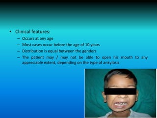 • Clinical features:
– Occurs at any age
– Most cases occur before the age of 10 years
– Distribution is equal between the genders
– The patient may / may not be able to open his mouth to any
appreciable extent, depending on the type of ankylosis
 