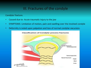 III. Fractures of the condyle
Condylar fracture.
• Caused due to- Acute traumatic injury to the jaw
• SYMPTOMS- Limitation of motion, pain and swelling over the involved condyle
• Deformity is noted upon palpation and loss of normal condylar excursion.
 