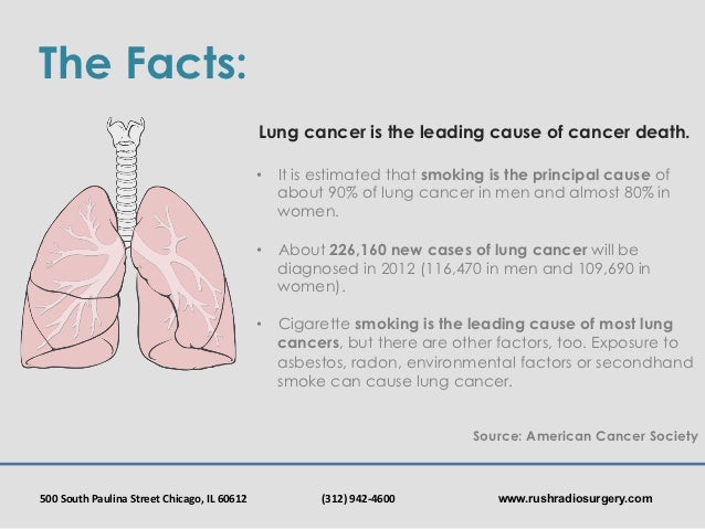 Rush Radiosurgery: Lung Cancer Awareness Month