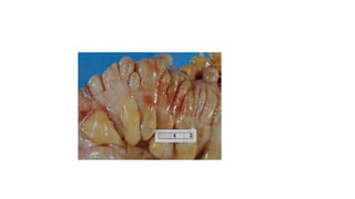 Sesamum; morphology;externel features; economic importance; products