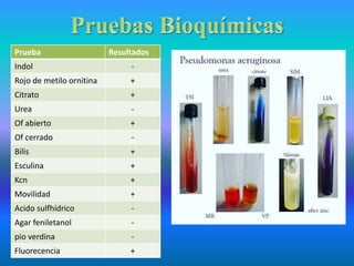 Prueba Resultados
Indol -
Rojo de metilo ornitina +
Citrato +
Urea -
Of abierto +
Of cerrado -
Bilis +
Esculina +
Kcn +
Movilidad +
Acido sulfhídrico -
Agar feniletanol -
pio verdina -
Fluorecencia +
 