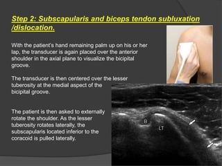 Step 2: Subscapularis and biceps tendon subluxation
/dislocation.
With the patient’s hand remaining palm up on his or her
lap, the transducer is again placed over the anterior
shoulder in the axial plane to visualize the bicipital
groove.
The transducer is then centered over the lesser
tuberosity at the medial aspect of the
bicipital groove.
The patient is then asked to externally
rotate the shoulder. As the lesser
tuberosity rotates laterally, the
subscapularis located inferior to the
coracoid is pulled laterally.
 