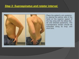 Step 3: Supraspinatus and rotator interval.
 