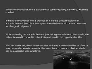 The acromioclavicular joint is evaluated for bone irregularity, narrowing, widening,
or offset.
If the acromioclavicular joint is widened or if there is clinical suspicion for
acromioclavicular joint disruption, dynamic evaluation should be used to assess
for changes in alignment.
While assessing the acromioclavicular joint in long axis relative to the clavicle, the
patient is asked to move his or her ipsilateral hand to the opposite shoulder.
With this maneuver, the acromioclavicular joint may abnormally widen or offset or
may cause a bone-on-bone contact between the acromion and clavicle, which
can be associated with symptoms.
 