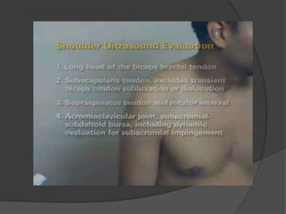 Shoulder ultrasound