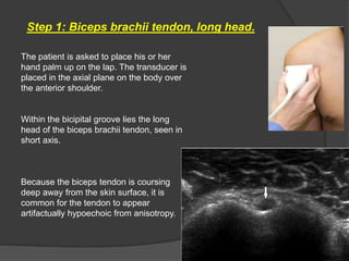 Step 1: Biceps brachii tendon, long head.
The patient is asked to place his or her
hand palm up on the lap. The transducer is
placed in the axial plane on the body over
the anterior shoulder.
Within the bicipital groove lies the long
head of the biceps brachii tendon, seen in
short axis.
Because the biceps tendon is coursing
deep away from the skin surface, it is
common for the tendon to appear
artifactually hypoechoic from anisotropy.
 