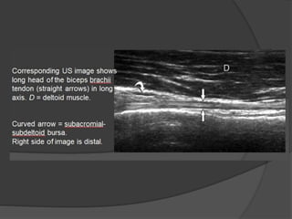 Shoulder ultrasound