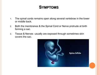 Spinal cord disorders | PPT