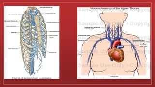 Superior vena cava syndrome