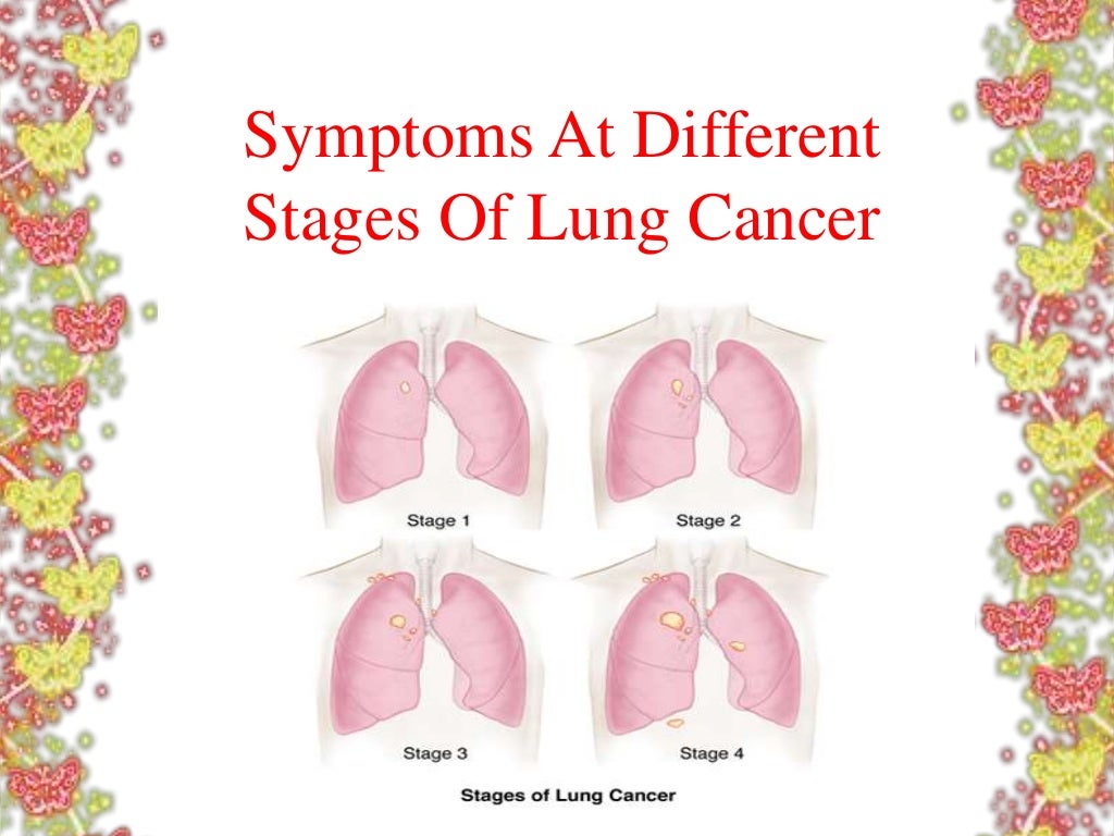 Symptoms at different stages of lung cancer