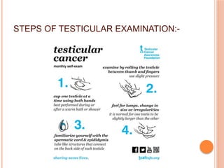 Testicular examination | PPT