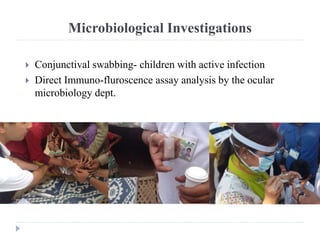 Microbiological Investigations
 Conjunctival swabbing- children with active infection
 Direct Immuno-fluroscence assay analysis by the ocular
microbiology dept.
 