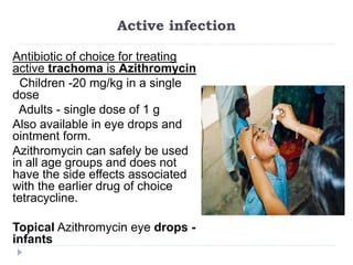 Active infection
Antibiotic of choice for treating
active trachoma is Azithromycin
Children -20 mg/kg in a single
dose
Adults - single dose of 1 g
Also available in eye drops and
ointment form.
Azithromycin can safely be used
in all age groups and does not
have the side effects associated
with the earlier drug of choice
tetracycline.
Topical Azithromycin eye drops -
infants
 